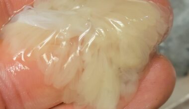 Is this octopus roe?