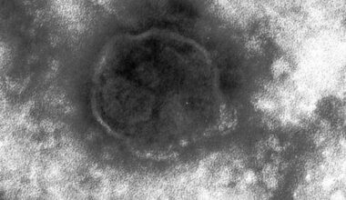 15 Measles Patients Confirmed in Tokyo in Past 6 Days; 1 May Have Come into Contact with Many in Shibuya. Tokyo metropolitan government is urging unvaccinated individuals to get vaccinated promptly