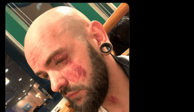 Aftermath of the Nick Wayne/Robbie X match (Night 1 Spoilers)